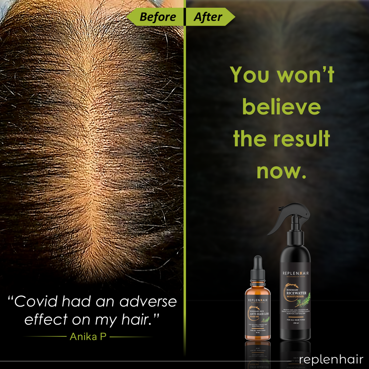 Replenhair Rosemary & Rice Water Hair Care Set – Spray and Oil