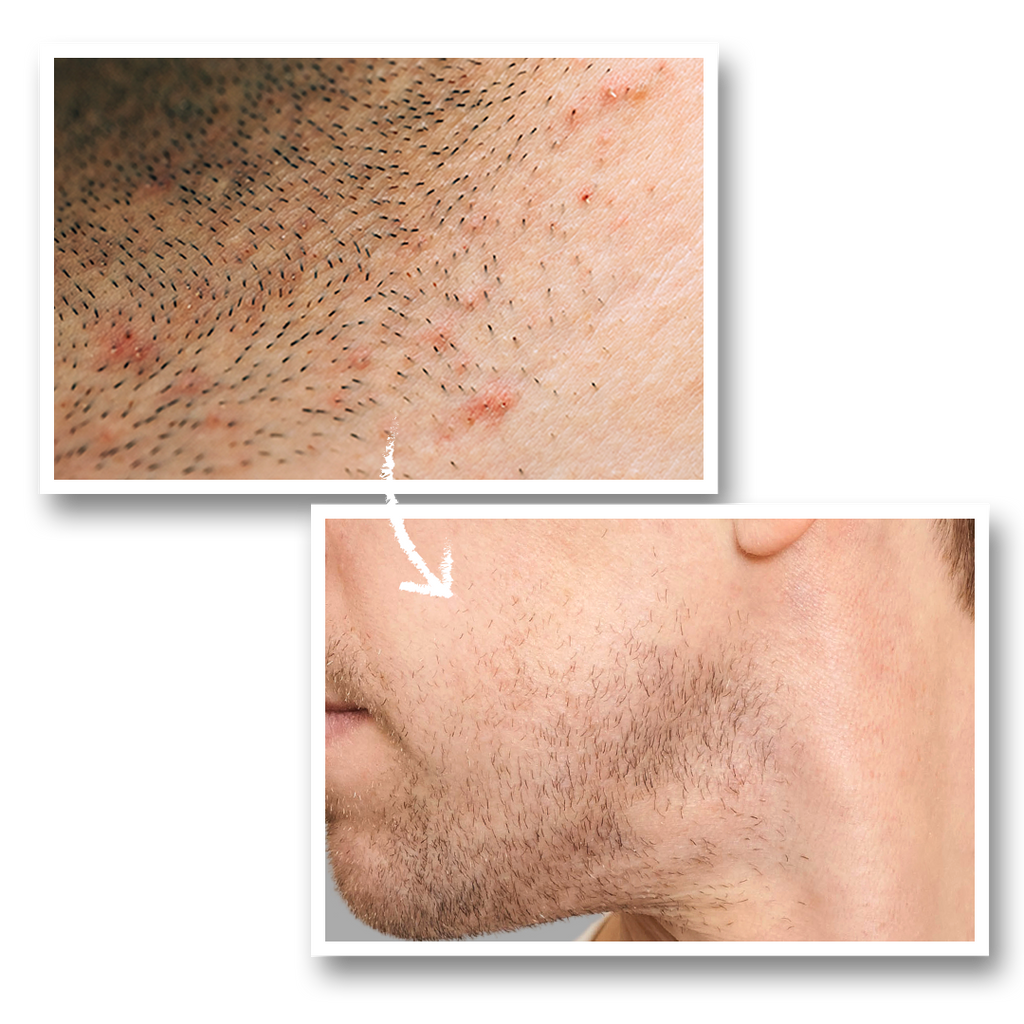 Calm As You Are – After-Shave Face Lotion