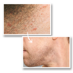 Calm As You Are – After-Shave Face Lotion
