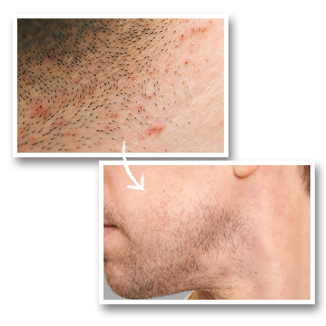 Calm As You Are – After-Shave Face Lotion